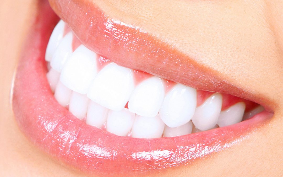 Soothe Sensitive Teeth After Whitening: Top Tips for Relief