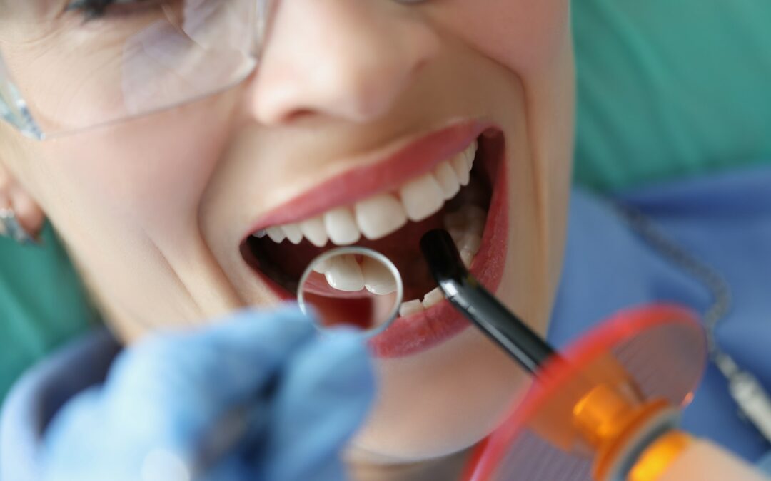Effective Solutions for Fixing Chipped Teeth Quickly