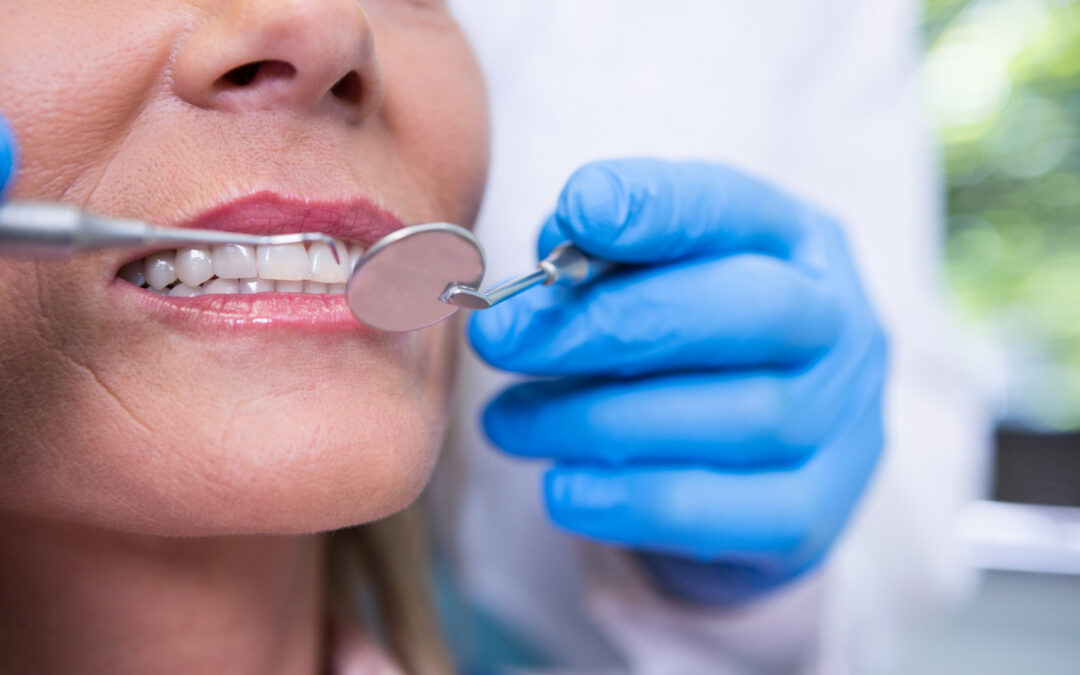 The Importance of Dental Cleanings for Preventative Care