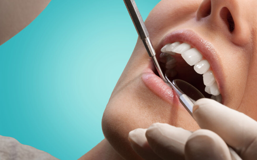 The Role of Dental Bonding in Fixing Front Teeth Issues