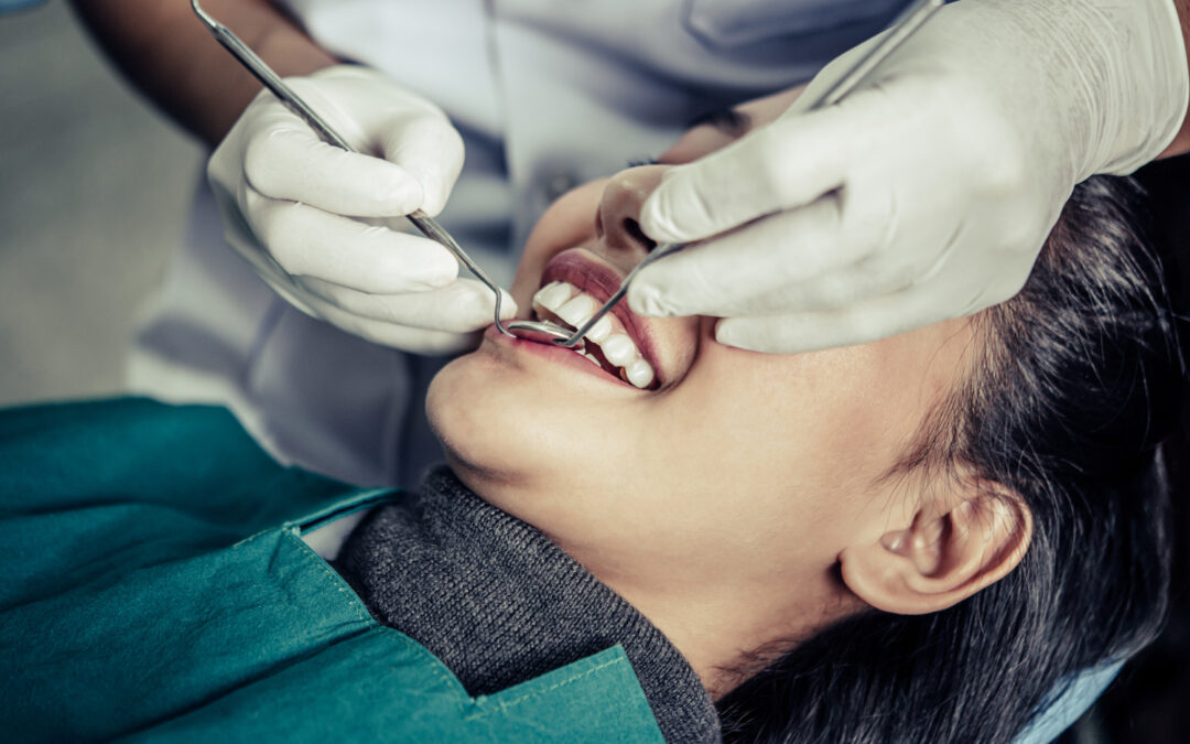 dental implants