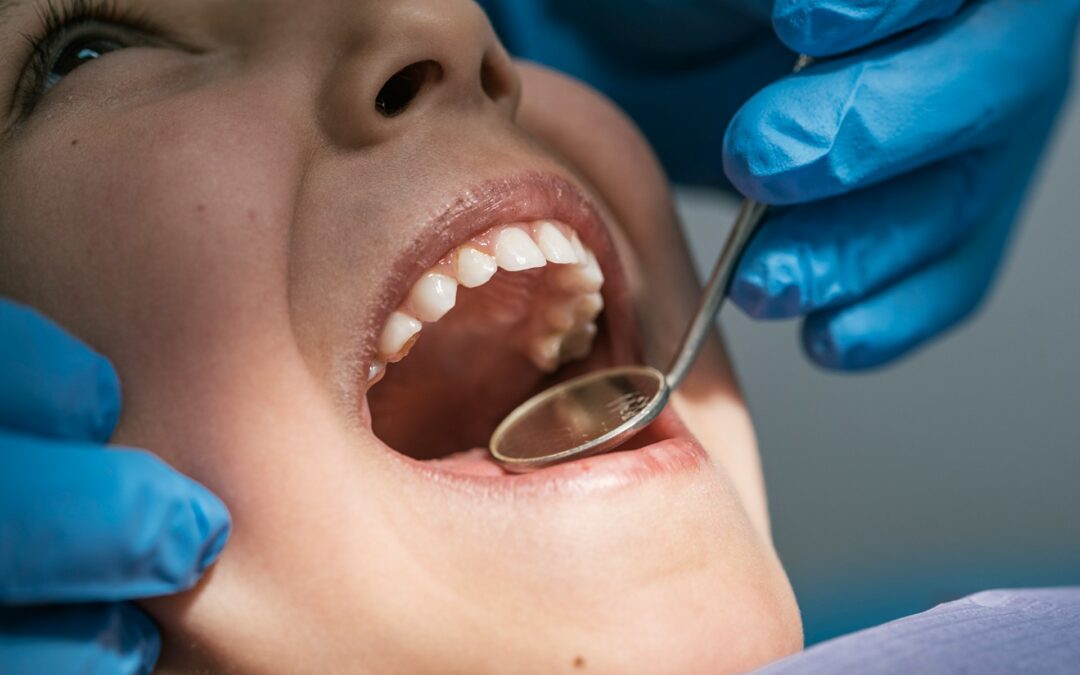 Common Summer Dental Emergencies and How to Handle Them